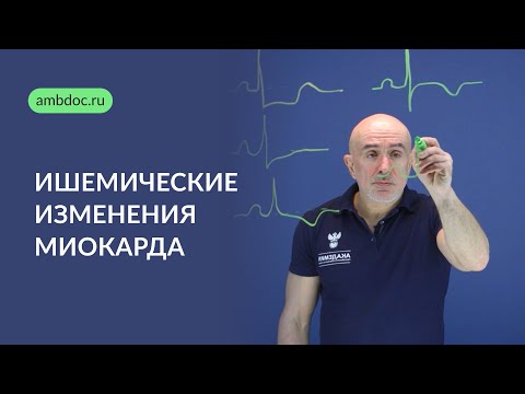 Ишемические изменения миокарда на ЭКГ