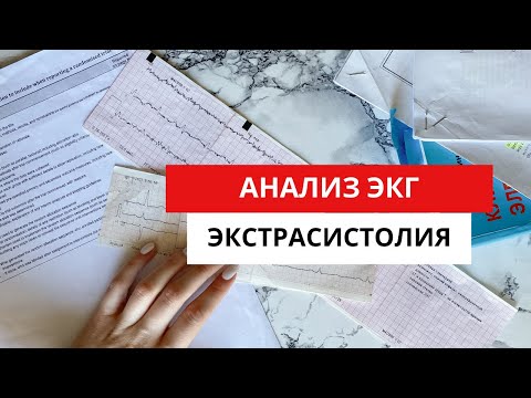 Extrasystole. ECG diagnostics. (Supraventricular and ventricular extrasystoles).