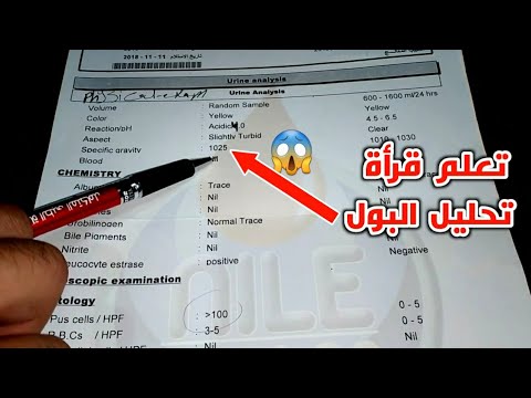 تعلم قرأة تحليل البول_Learn to read urine analysis