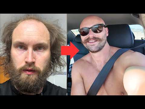 Glow Up Guide For Balding Men