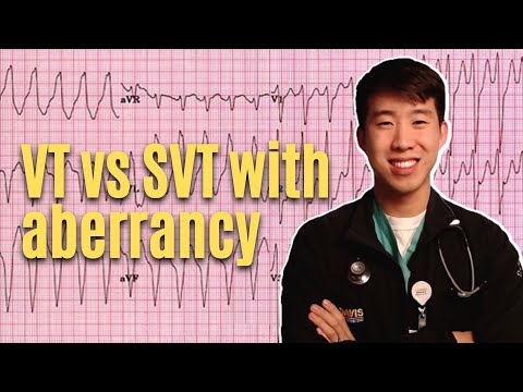 VT vs. SVT With Aberrancy Explained - High Yield & Made Easy!