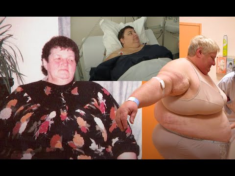 Lutte contre l'obésité : Prête à tout pour maigrir | Le combat continue