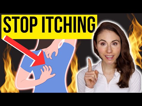 HOW TO STOP ITCHING ON THE BACK | Notalgia Paresthetica