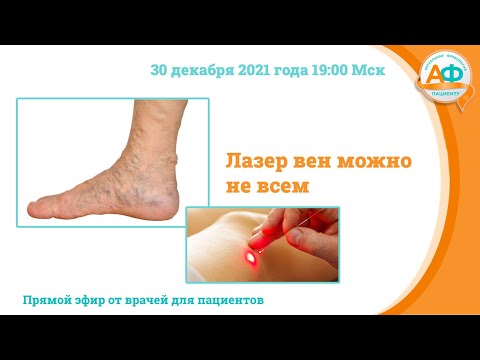 Лазер вен можно не всем