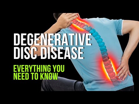 Degenerative Disc Disease Explained for Everyone!
