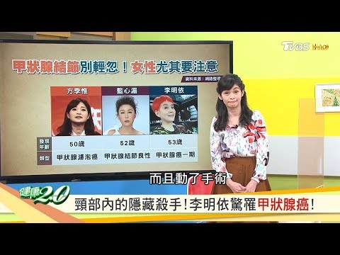 頸部內的隱藏殺手！李明依驚罹甲狀腺癌！ 健康2.0 20200501 (完整版)