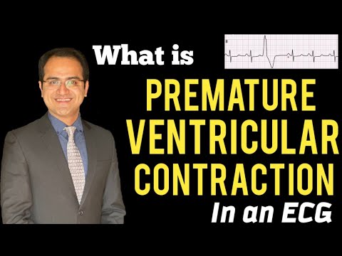 Premature Ventricular Contraction/Complex (PVC) ECG Explained, Treatment, ECG Lectures USMLE/NCLEX