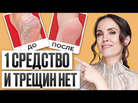 Baby-Smooth Heels / An Affordable Remedy for Everyone