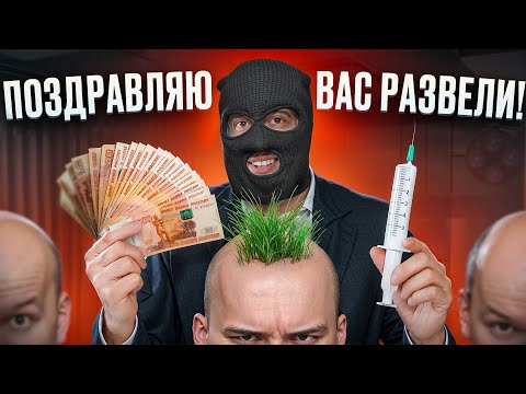 КАК ВАС РАЗВОДЯТ КЛИНИКИ ПО ПЕРЕСАДКЕ ВОЛОС?