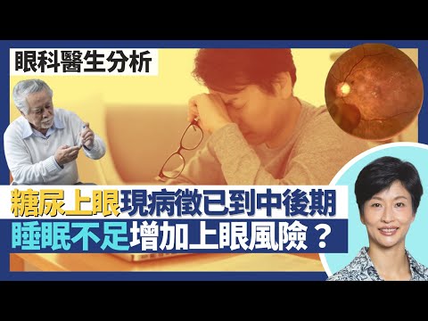 糖尿上眼｜逾2成糖尿病人會上眼 血糖高致眼睛血管滲血！糖尿上眼初期無病徵 視力出問題已到中後期？睡眠不足增加糖尿上眼風險 高血壓都會影響視力？｜王建芳醫生 眼科醫生袁尚清醫生｜人類健康研究所