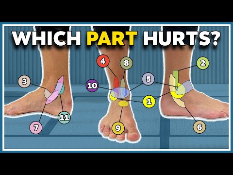 My ankle hurts here! 11 typical pain spots and what they mean