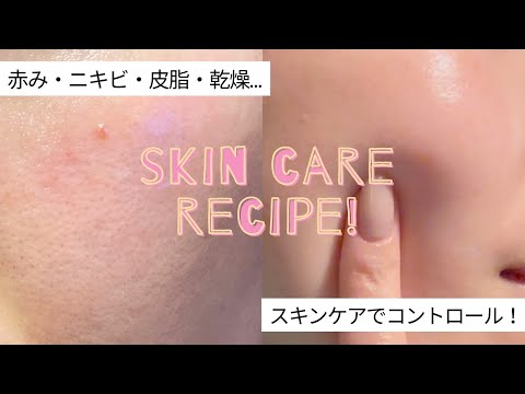 【ニキビできそうな日】ドラッグストアで揃う！ニキビを未然に防ぐ夜のスキンケアルーティン