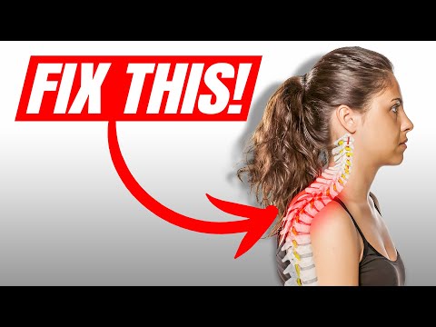 The #1 Most Important Muscle To Fix Neck Hump