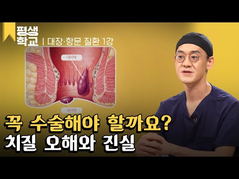 [#EBS평생학교] 1강 치질│윤상민의 친절한 주치의 - 대장·항문 질환