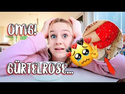 HILFE ICH HABE GÜRTELROSE...ES TUT SO WEH | MaVie Noelle
