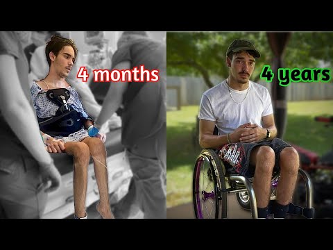 Paralyzed at 18 - My Story