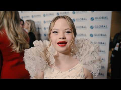 Family adopts girl with Down syndrome from Ukraine, she lands role in Hunger Games - Sofia Sanchez