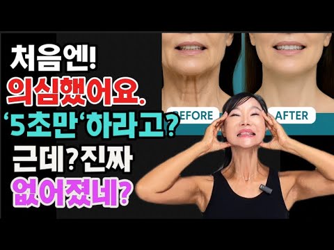 Vertical wrinkles? 5 seconds is all it takes! Even skin experts are impressed with the method rev...