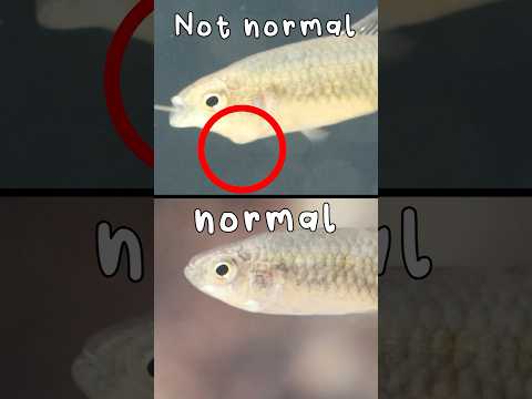 I had to do surgery….