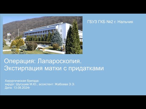 Экстирпация матки с придатками лапароскопическая операция (гинекология). Хирург Шугушев Мурат