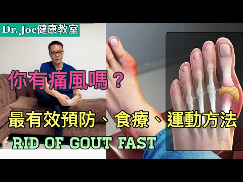 你有痛風嗎？腳趾公腳趾刺痛，膝頭痛走路困難! 最有效預防、食療及運動方法 [Eng Subtitles] Get Rid of Gout Fast