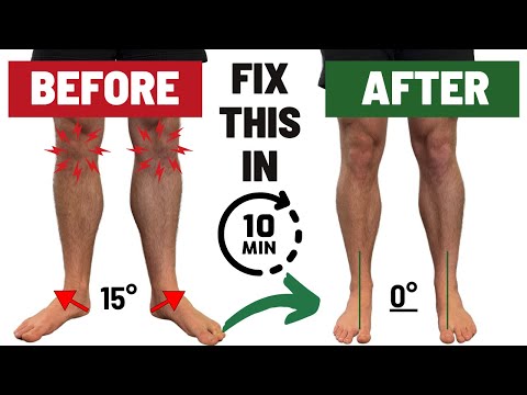 How To Fix Duck Feet FAST | Fixing Ankle Dorsiflexion, Tibial IR, & Hip IR