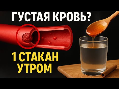 БОИШЬСЯ ТРОМБОВ? УТРЕННИЙ НАПИТОК + 3 ОШИБКИ, ЧТО СГУЩАЮТ КРОВЬ