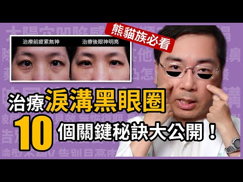 治療淚溝型黑眼圈，10個關鍵秘訣大公開！林政賢醫師讓你擺脫疲累感。