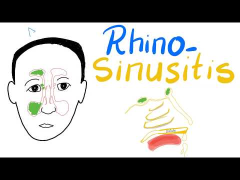 Rhinosinusitis (Acute& Chronic): Clinical Picture, Diagnosis& Management + Cases