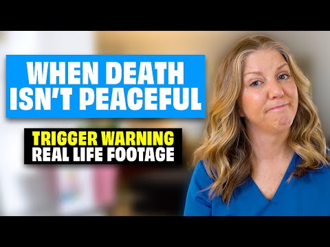 What Causes Restlessness Before Death? A Look at Terminal Agitation