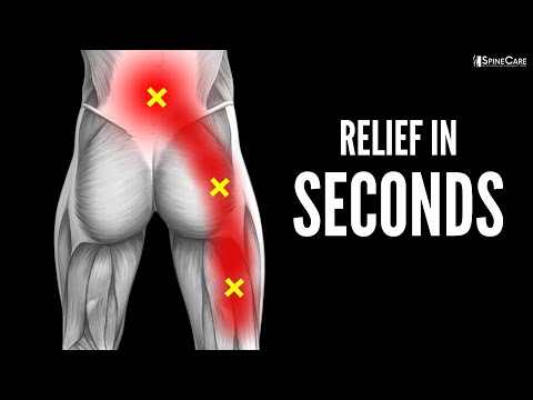 30 SECOND FIX: Instant Sciatica Pain Relief