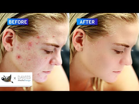 5 Step Next-Level Skin Retouching in GIMP