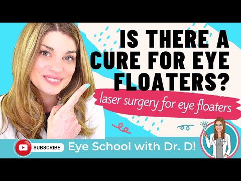 Is There a Cure for Eye Floaters? Eye Doctor Explains Laser & Surgical Options for Eye Floaters