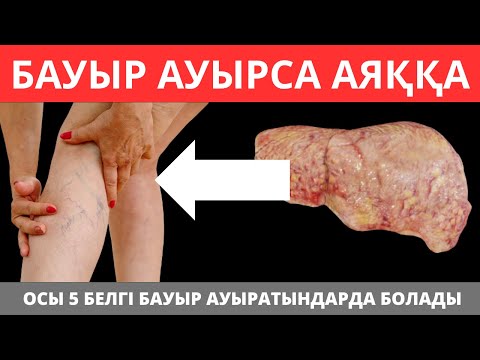 Бауырдың ӨЛІП ЖАТҚАНЫН көрсететін алғашқы 5 БЕЛГІ. БАУЫР АУРУЛАРЫНЫҢ ЕҢ АЛҒАШҚЫ БЕЛГІЛЕРІ