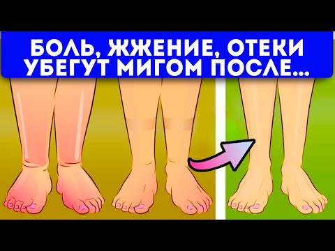 Невероятно, ноги как пушинки! 15 домашних способов от отеков ног