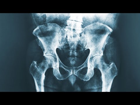 A Farmer Sprayed 1 Liter Pesticide Inbetween His Legs. This Is How His Organs Shut Down.