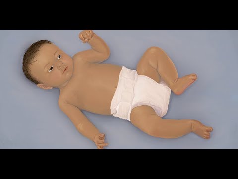 Bronchiolitis by A. Growdon | OPENPediatrics