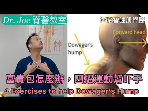 富貴包怎麼辦，四招運動幫吓手  [Eng Subtitles] 4 exercises to help Dowager’s hump