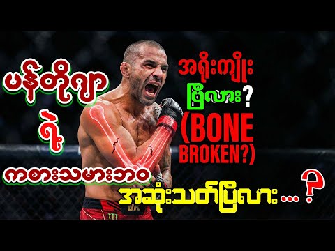 ပန်တိုဂျာရဲ့ ကစားသမားဘဝ အဆုံးသတ်ပြီလား? Terrible Triad ဒဏ်ရာရဲ့ ကြောက်ခမန်းလိလိ အမှန်တရား