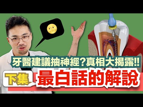 【史上最白話的抽神經解密(下)終於姍姍來遲了！】為什麼牙齒暴痛後會突然不痛了？不痛的牙齒之後會有什麼命運？挖蛀牙看到牙髓暴露就一定要抽神經嗎？什麼是活髓治療？和抽神經差在哪裡？