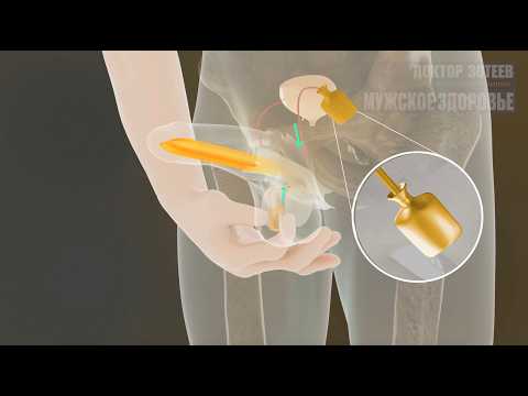 ВСЕ ОБ ЭРЕКЦИИ за 15 минут. Эректильная дисфункция как лечить