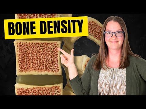 5 Best Ways to Improve Your Bone Density