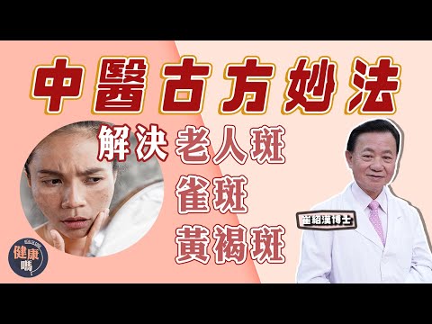 女士恩物！祛斑方法大公開 解決頑固色斑｜祛斑要治標治本 保養皮膚同時抗衰老｜穴位湯水面膜 消滅老人斑雀斑黃褐斑｜健康嗎 @@健康嗎 Health Code 【問問崔博士】#祛斑 篇 下集