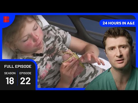 Child’s Playground Fall Leads to ER Emergency | 24 Hours In A&E