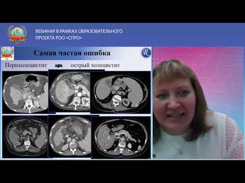 КТ диагностика воспалительных заболеваний желчевыводящих путей и желчного пузыря