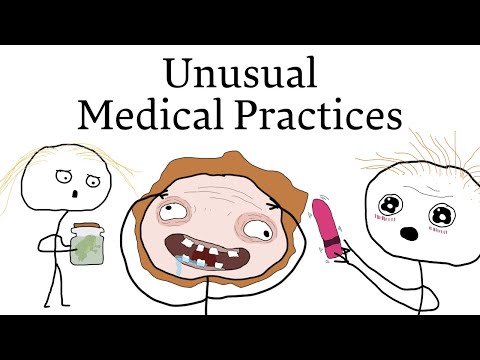 Unusual Medical Practices Through History