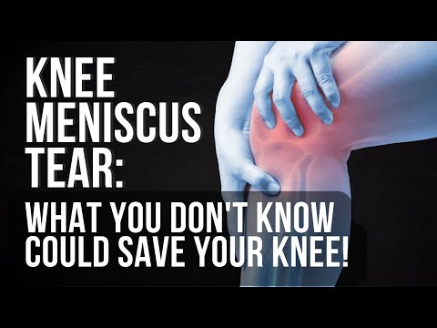 I Tore My Knee Meniscus, Now What?