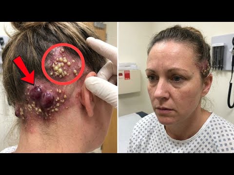 She Felt Something Moving Behind Her Ear — What Doctors Found Shocked Everyone