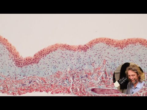 Histology of the bladder