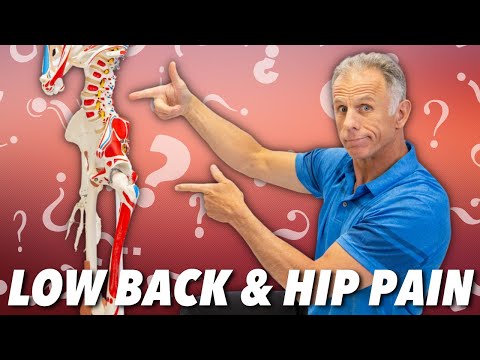 Low Back & Hip Pain? Is it Nerve, Muscle, or Joint? How to Tell.